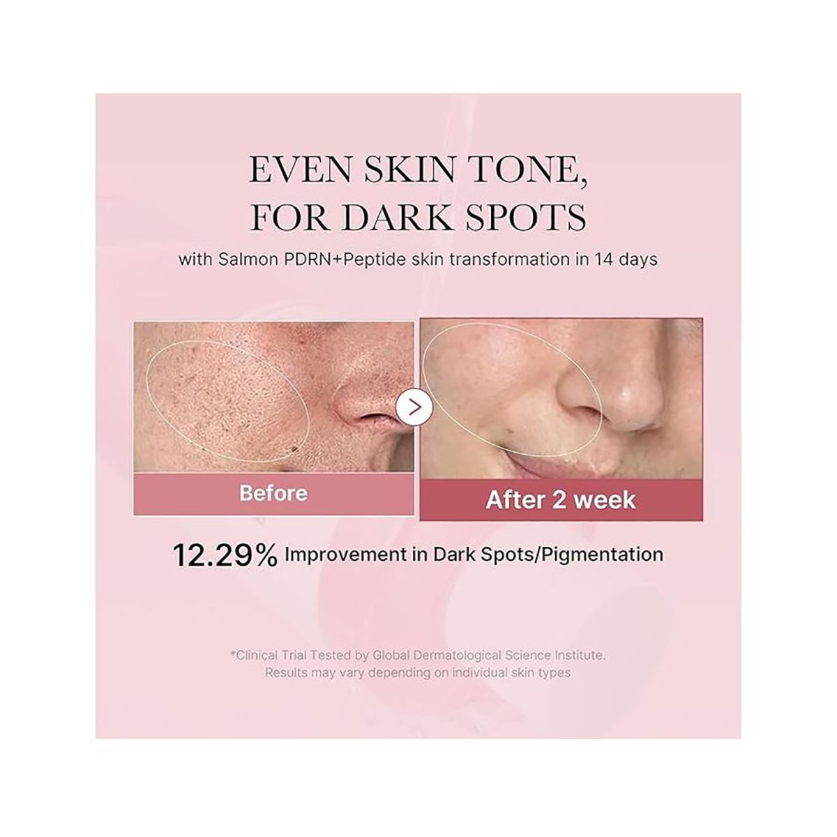 Medicube PDRN Pink Cica Soothing Toner 250ml - Image 5